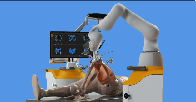 robotic knee replacement surgery in Mumbai