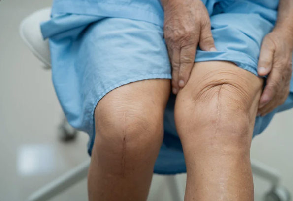 knee replacement surgery in Jaipur
