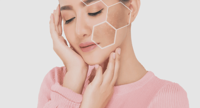 Pigmentation treatment in Mohali