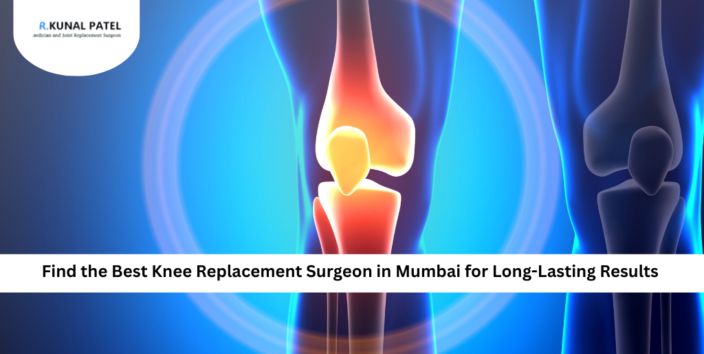 Best Knee Replacement Surgeon in Mumbai