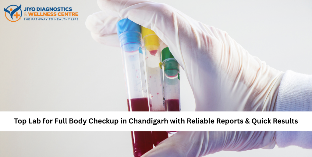 Full Body Checkup in Chandigarh