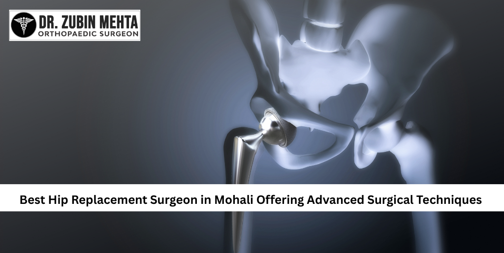 best hip replacement surgeon in Mohali