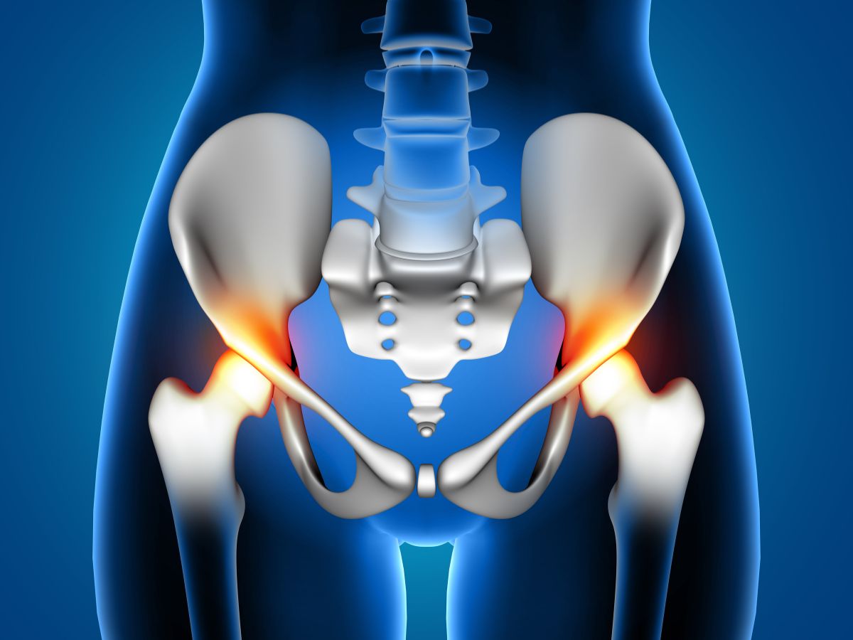 Hip Replacement Mohali